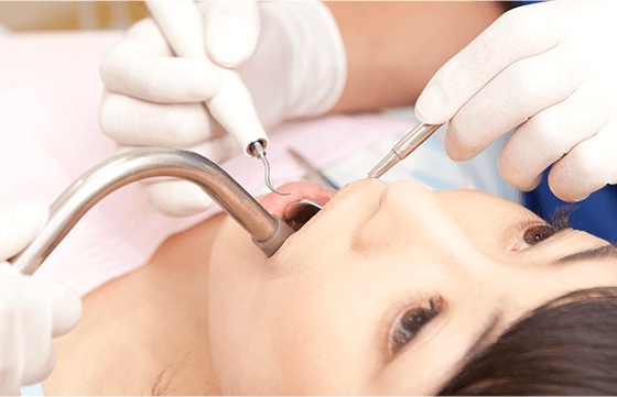 奥歯の治療